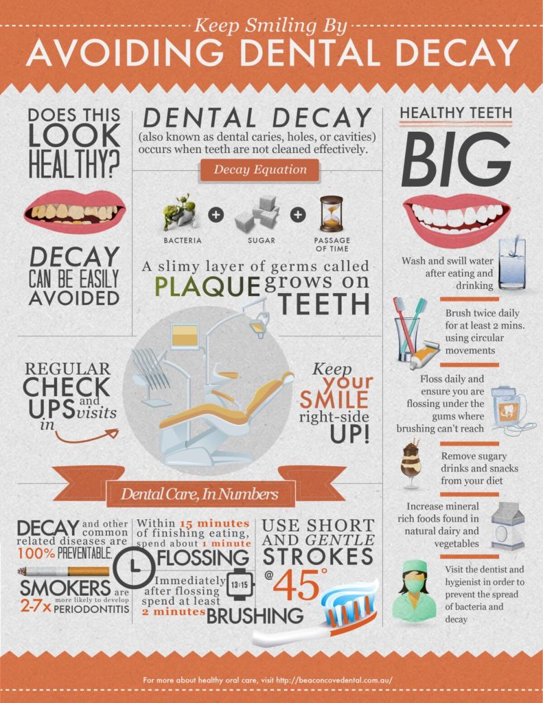 How to Prevent Tooth Decay with 5 Simple Tips